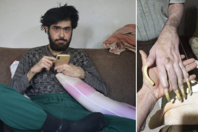 3 YILDIR DUŞ ALMAYAN GENÇ: CANIM HİÇBİR ŞEY YAPMAK İSTEMİYOR