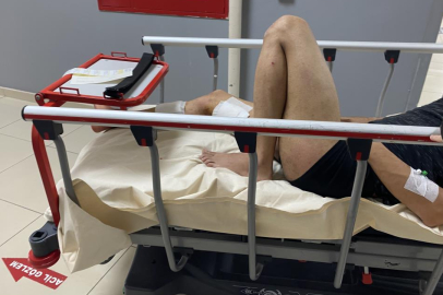 BURSA'DA SİGARA VERMEYİNCE BACAĞINDAN BIÇAKLANDI