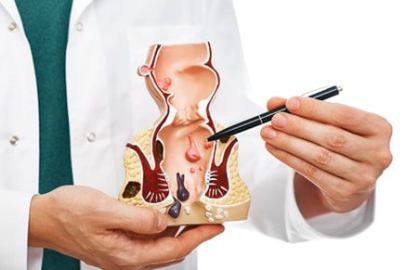 HEMOROİD TEDAVİSİNDE KİŞİYE ÖZEL MODERN YÖNTEMLER