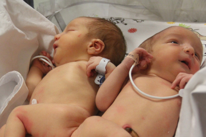 DEPREMLE ÖKSÜZ KALAN SİYAM İKİZLERİNİ ÖLÜM AYIRDI