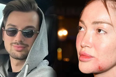 FENOMEN DANLA BİLİC’İ DARP EDEN ESKİ SEVGİLİSİNE 5 AY HAPİS