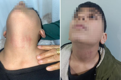 OKULDA 10 YAŞINDAKİ ÖĞRENCİNİN DARBEDİLDİĞİ İDDİASI