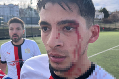 MAÇ SONRASI KAVGA: 3 FUTBOLCU HASTANELİK OLDU