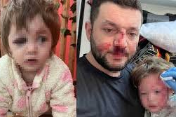 KOMŞU KAVGASINDA 14 AYLIK BEBEK HASTANELİK OLDU