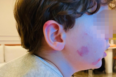 KREŞTE SKANDAL: 2,5 YAŞINDAKİ ÇOCUK DARP EDİLDİ