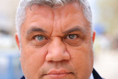 ÜÇ RENKLİ GÖZLERİYLE DİKKAT ÇEKİYOR