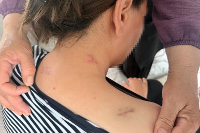 17 BIÇAK DARBESİNE RAĞMEN ÖLÜ TAKLİDİ YAPARAK HAYATTA KALDI