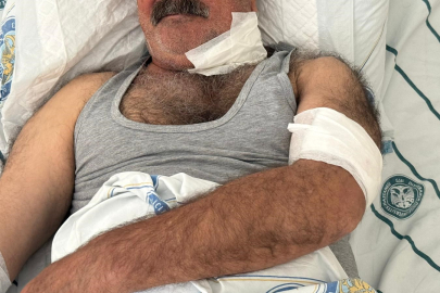 AT SAHİBİNİ BOĞAZINDAN ISIRARAK AĞIR YARALADI