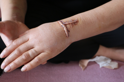 DİYARBAKIR’DA DEHŞET: EŞİNİ 30 YERİNDEN BIÇAKLADI