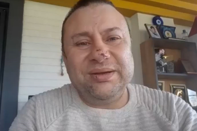 PİTBULL SALDIRISINA UĞRAYAN SANATÇI: “ÖLÜMDEN DÖNDÜM”