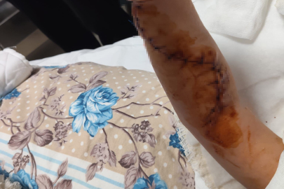 1,5 YAŞINDAKİ ÇOCUK TOMOGRAFİ SONRASI KABUSU YAŞADI
