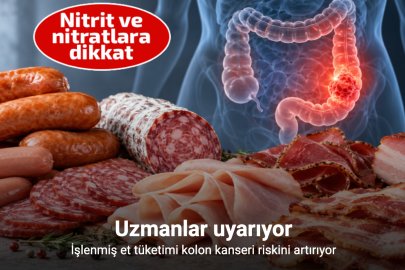 HALA ET YİYEBİLENLER DİKKAT! KOLON KANSERİ RİSKİNİ ARTIRIYOR